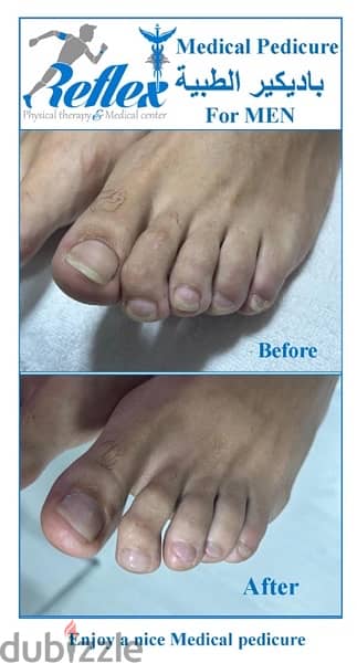 Medical Pedicure for Men 1