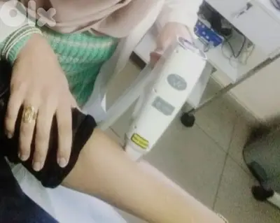 علاج إزالة الشعر تحت إشراف اخصائيين
