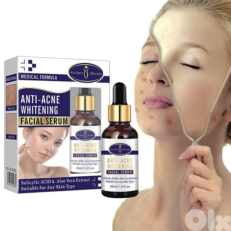 Aichun Beauty Anti-Acne Serum – Repairs, Brightens, Clears Skin (30ml) 0