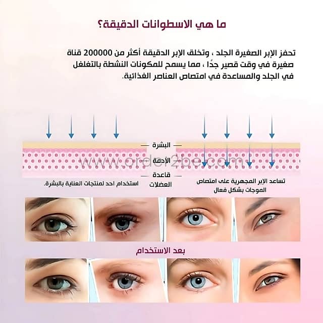 Painless Derma Roller System with 540 Needles for Wrinkle-Free Skin 5