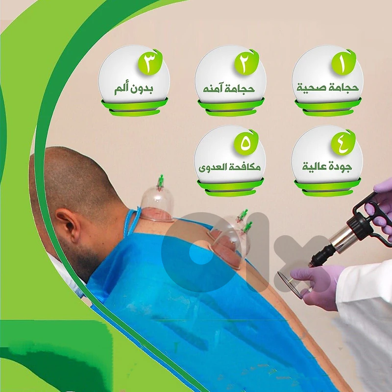 cupping therapy