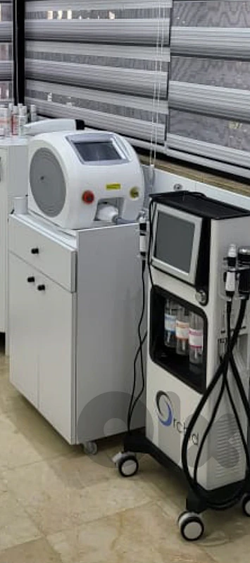 carbon laser machine or tatto removal machine