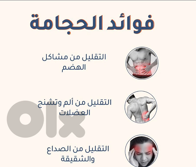 cupping therapy