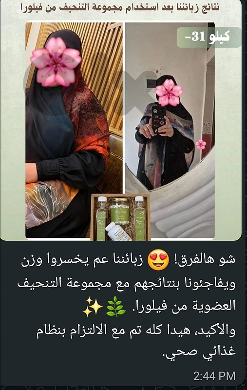 نتائج زبائننا بعد استخدام مجموعة التنحيف من فيلورا