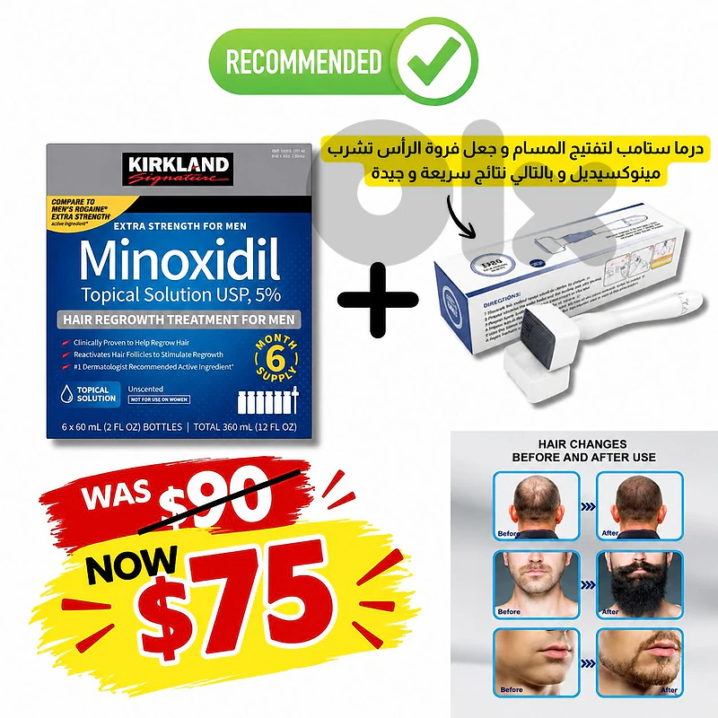 minoxidil kirkland box minoxidil kirkland box