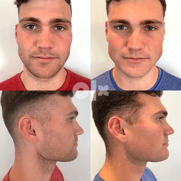 jawline 1