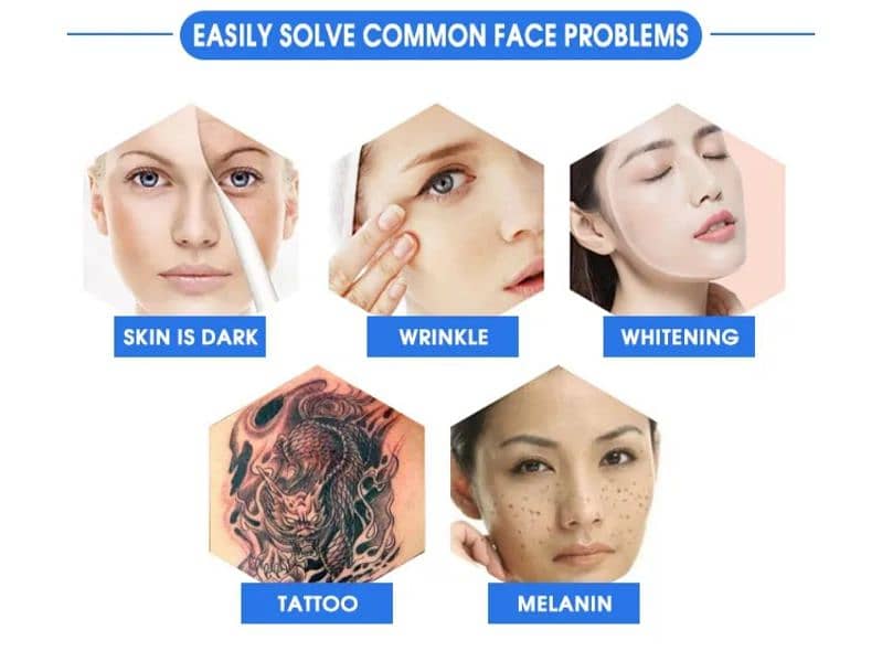 Tattoo Removal, Permanent Make-up Removal Nd Yad Laser Machine 3